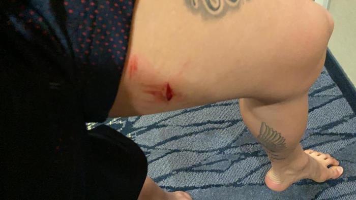 Irmão de Jean posta foto do goleiro ferido; Pai cita caso Neymar