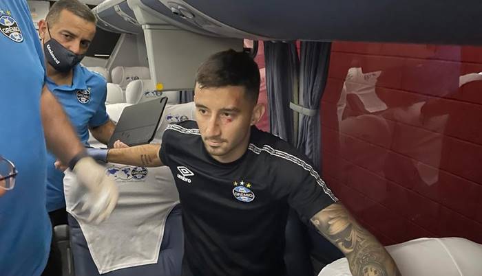 Ônibus do Grêmio é alvo de pedradas e jogadores são atingidos