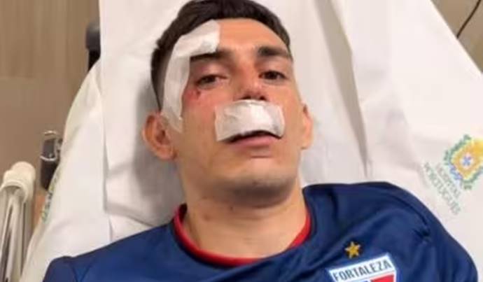 Bahia e Vitória repudiam ataque sofrido pela delegação do Fortaleza