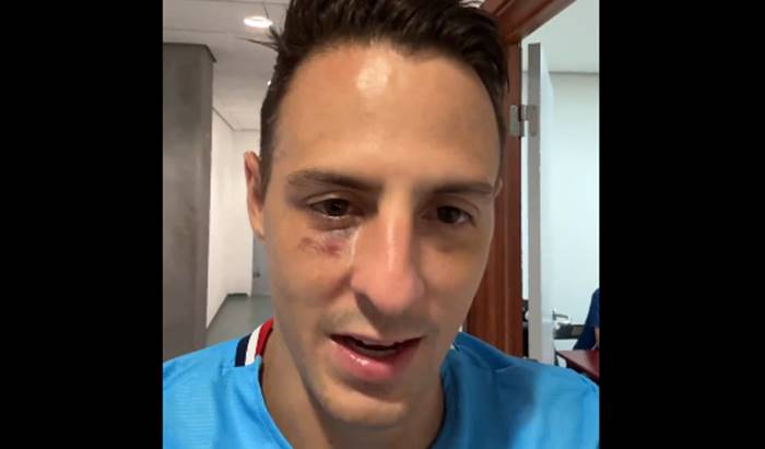 Árias mostra hematoma no rosto após lance com Gregore: “Nada grave”